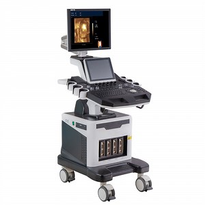 [Hot Item] 3D 4D Trolley Cardiac Color Doppler Ultrasound Scanner