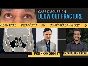 Case Discussion: Blow out fracture for residents