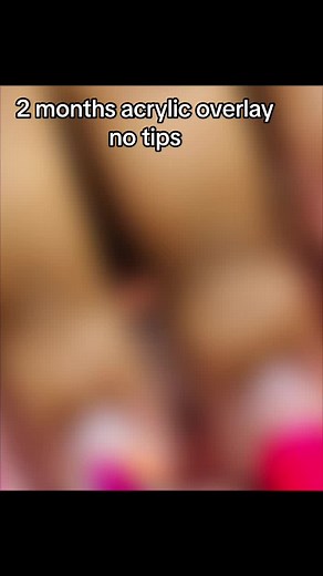 Long-Lasting Acrylic Overlay on Natural Nails | Nail Inspiration