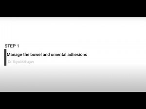 STEP 1 : BOWEL AND OMENTAL ADHESIOLYSIS