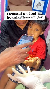 ⛑I removed a lodged iron pin 🧷from a finger. Do you like that ? 📎 Save and share it •• •• • #FingerInjury #IronPinRemoval #MedicalProcedure #WoundCare #EmergencyMedicine #DoctorAtWork #HandInjury #MinorSurgery #Healthcare #firstaid #healthtips #viral #trendingreels #trend #selfcare #selfcare #healthylifestyle | Zane Alam Dewan