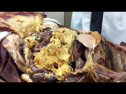 VÍDEO AULA PRÁTICA DE PERITÔNIO