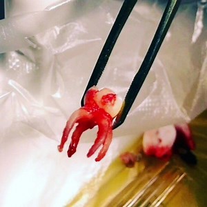 1K views · 19 reactions | 嵐Are You Ready Tonight ?? Story Of Extraction  4 Roots From Different 4 Families 濫 But, How ?? And if you were The Operator Can You Extract It WithOut Fractured root 嵐嵐 ✋✋Don't Be Ordinary . Work Hard work Smart. Time To Be A Great Dentist .. We are With You ❤ #Dentistry #The_Genius_Prof Credits: Dental Surgeon | The Genius Prof | Facebook