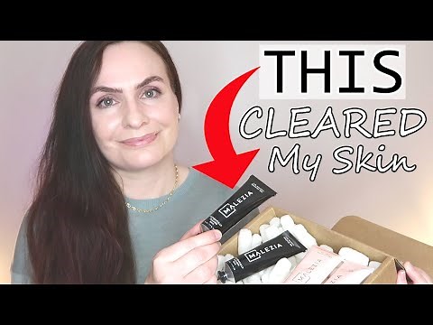 This Will Clear ACNE + CYSTS + FUNGAL ACNE + Malassezia Folliculitis | Malezia Skincare