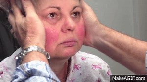 Positive Head Impulse when head turned to the left on Make a GIF