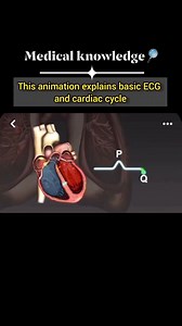 💙👉#Introduction #to #ECG📃🔎 📃👉An electrocardiogram is a picture of the electrical conduction of the heart. By examining changes from normal on the ECG, clinicians can identify a multitude of cardiac disease processes. 💙There are two ways to learn ECG interpretation — pattern recognition (the most common) and understanding the exact electrical vectors recorded by an ECG as they relate to cardiac electrophysiology and most people learn a combination of both. 💙👉This tutorial pairs the appro