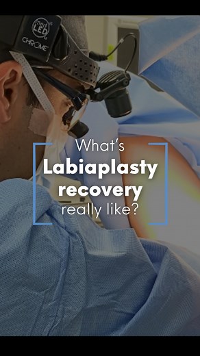 🌻People often ask me about the recovery process after a labiaplasty, and my answer is always the same: it’s quite manageable! A labiaplasty is generally not a painful procedure, and in most cases, strong painkillers aren’t needed For the first few days use a squeeze bottle to clean the area after using the restroom, use an ice pack to reduce swelling, and relax and watch some of your favorite movies. After a week you’ll be able to walk and do normal physical activity, and after 3 weeks you can 