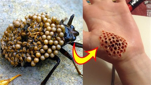 13 reactions | 10 Most Dangerous Bugs In The World | Unexplained Mysteries Video | Facebook