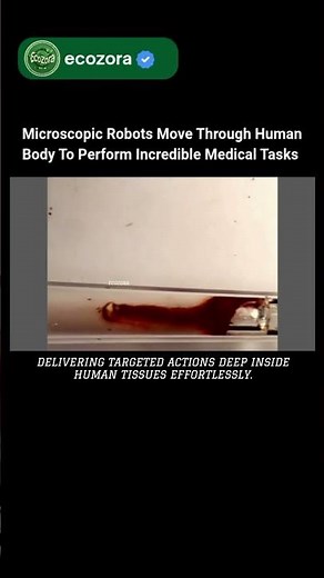 Microbots Turn Fantastic Voyage Into Real Medical Science #microbots #science #future #medicine