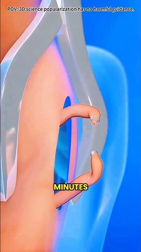 Vasectomy Procedure Explained | Male Birth Control 3D Medical Animation