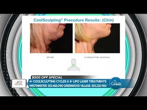 Coolsculpting Gets Results! // MD Body & Med Spa