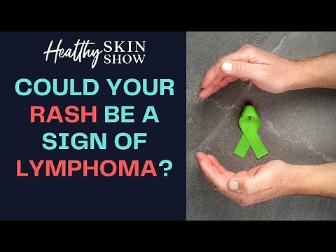 Could Your Rash Be A Sign Of LYMPHOMA? | Dr. Peter Lio