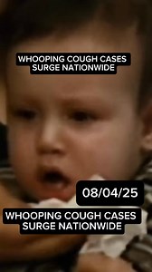🚨 WHOOPING COUGH CASES SURGE NATIONWIDE🚨 | Jorge DeSantiago