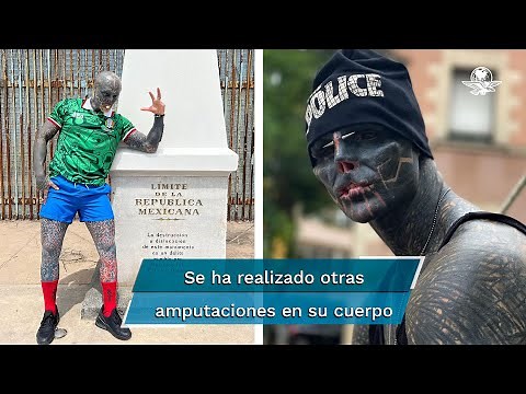 Hombre que quiere convertirse en alíen ahora se quitará una pierna para su transformación