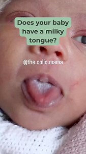 234K views · 761 reactions | Does your baby have a milky tongue? 樂...