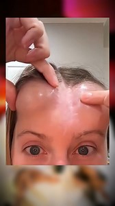 78K views · 69 reactions | Hospital se aane ke baad, is ladki ne sir...