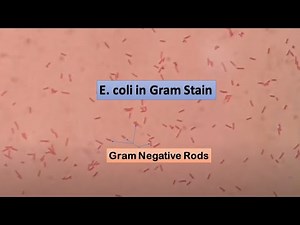 E coli in Grams stained smear of culture | Gram negative Bacilli | Gram Negative Rods