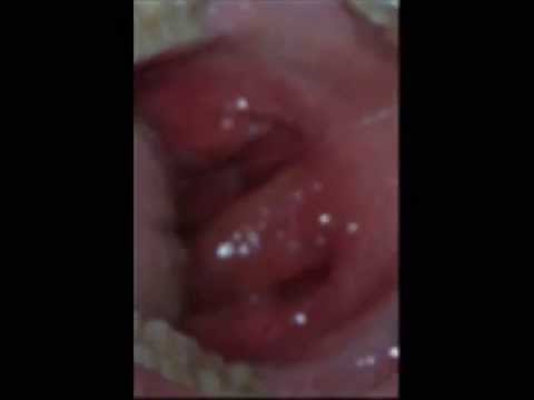Guinness world record 2012 human biggest clitoris
