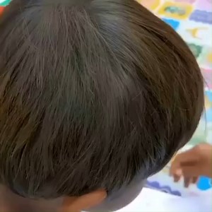 4.9K views · 44 reactions | Getting out all lice from head | Natural Lice | Facebook