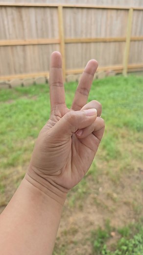 #TCM #chineseacupuncture #MigraineRelief #acupuncture #migraines #acupoint #WellnessJourney2024 #mucustreatment #TCMwellness #handexercises #blurryvision #acupunctureworks #chinesemedicine | June Seals