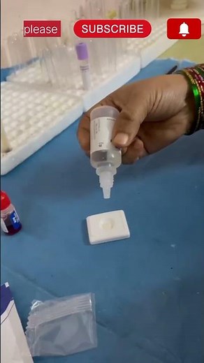Hiv Tridot Test Procedure/Aids Test//Negative Or Positive Test #virlshort #viral