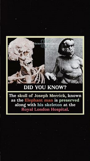 The Real Story of the “Elephant Man” 😳 #animalfacts #facts #didyouknow #shorts #usa