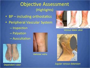 Cardiac Assessment Highlights for Nursing Students