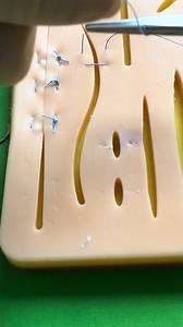 80K views · 709 reactions | Inverting horizontal mattress suture | Dermhacks | Facebook