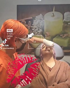 Rellenos de labios hermosos y súper naturales  Procedimiento:...