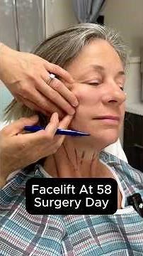 Facelift At 58 - Surgery Day (Interview)