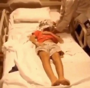 30K views · 344 reactions | SIGNO DE BRUDZINSKI Uno de los síntomas...