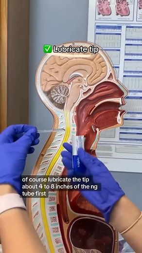 Comment se pose une sonde naso-gastrique | Biologies médicales