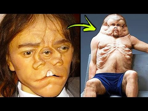 Top 10 Odd And Bizarre People In The World