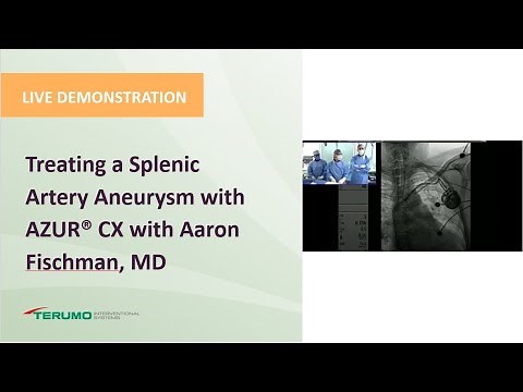 Treating a Splenic Artery Aneurysm with AZUR® CX w Aaron Fischman, MD| Terumo Interventional Systems