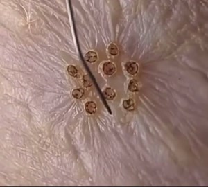 Close up on plasmage treatment 🥰 Skin tightening at the highest level. Pm if you have a question 🙋‍♀️ | Maria Klos Aesthetics