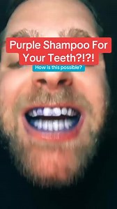 418 views | Reel by SNOW Teeth Whitening