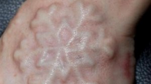 Body modifier’s deadly treatments exposed