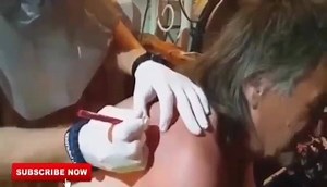 OMG Huge pimple on back !!! | Pimple Stuff