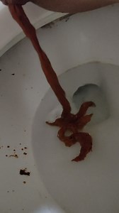 Korean girl diarrhea bowlcam