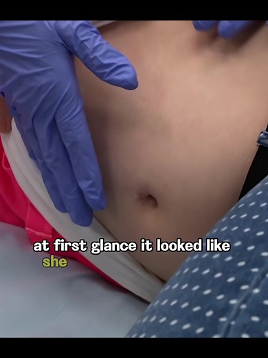 #untoldstoriesoftheer #erdrama #hospitalstories #emergencyroom #truemedicalcases