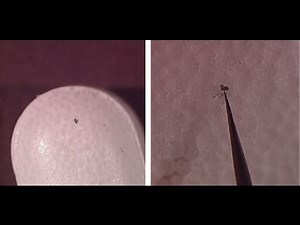 Identifying Foreign Particulate in Pharmaceutical Products