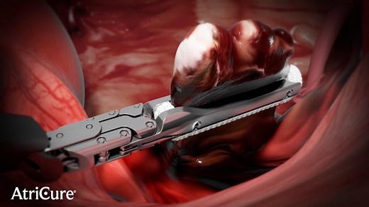 AtriClip PRO2 Animation