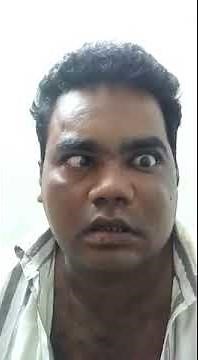 Lateral rectus palsy in invasive fungal sinusitis