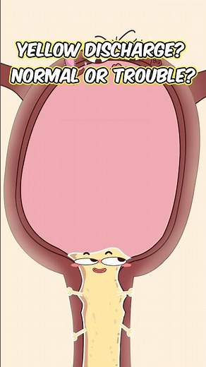 Yellow discharge?! Normal or trouble?