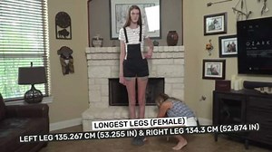Meet the girl with longest legs in the world, here's what she wants to become in life