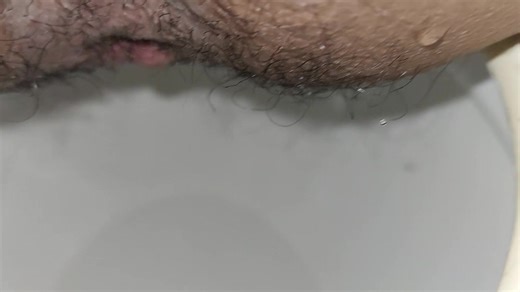 Turds coming out of my stinkhole