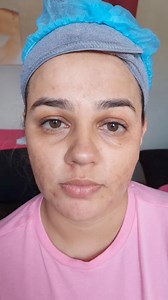 Tratamientos Faciales. Estamos en Nicaragua. Managua y Estelí. Pregunta por nuestro tratamiento anti acné y nuestro tratamiento anti mancha. #Nicaragua #esteticafacial #acne #limpiezafacial #womenside | Women Side Nicaragua