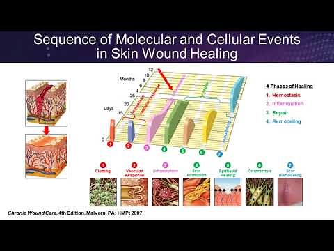 How Science Can Guide Practice: Placental Based Allografts