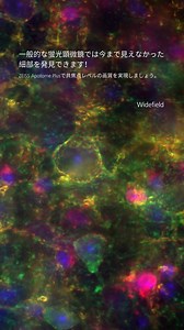 難しいサンプルや薄暗いサンプルでも、より良い画質を実現します！ZEISS Apotome Plusを使用すれば、コントラストを向上させ、焦点外の光を除去し、研究に最も重要な細部を捉えることができます。簡単かつ正確にイメージングを最適化できます。 溺 | ZEISS Microscopy | Facebook