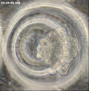 File:Adult-Cardiac-Progenitor-Cell-Aggregates-Exhibit-Survival-Benefit-Both-In-Vitro-and-In-Vivo-pone.0050491.s002.ogv - Wikimedia Commons